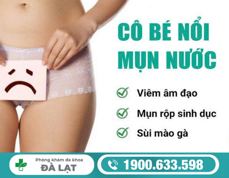 Hình ảnh minh họa